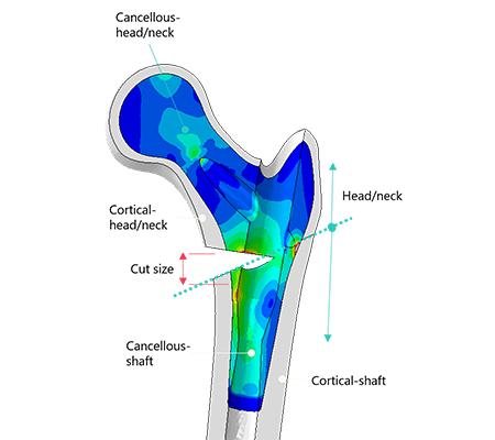 Digital illustration of a bone.